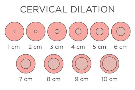 cervical dilation chart|3 cm dilated how much longer.